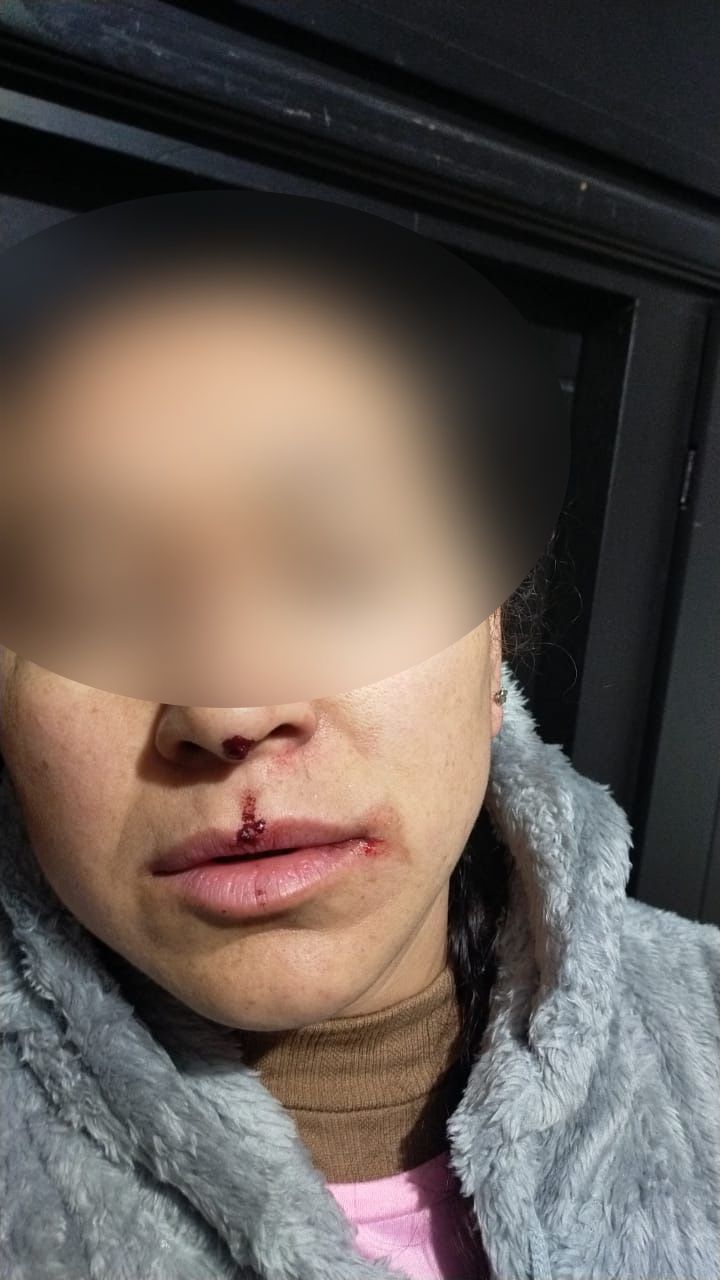 Ayuntamiento de Huamantla atiende oportunamente reporte de agresión de caninos y reitera su compromiso con el bienestar animal